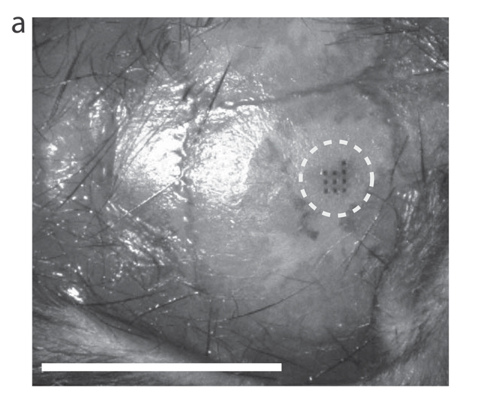 mouse laser surgery, brain surgery