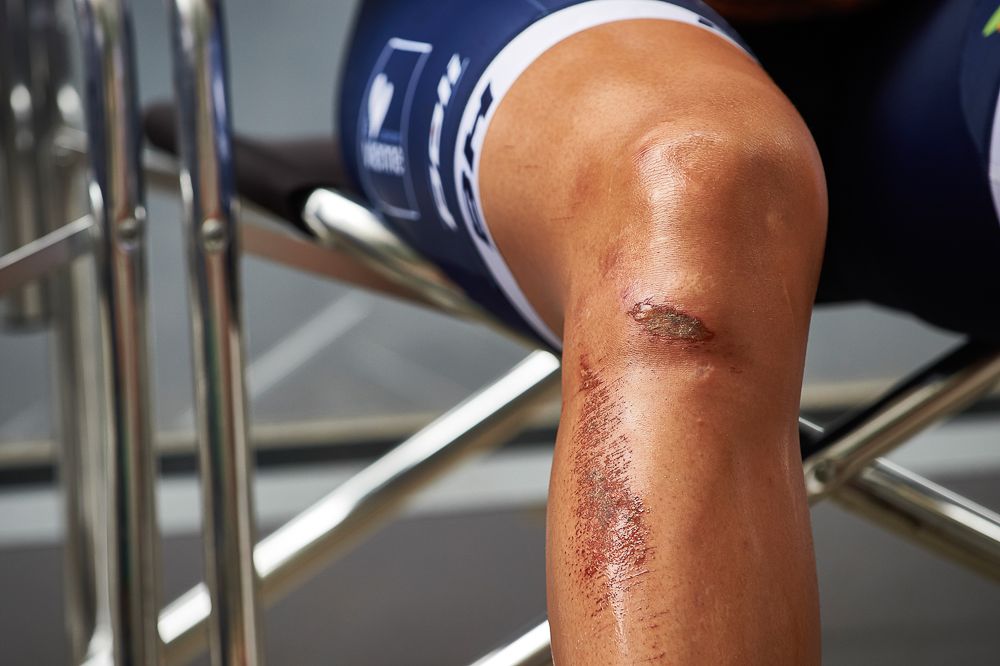 Scars to prove it