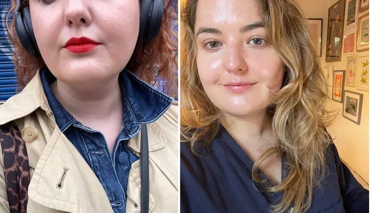 Beauty Editor Rhiannon before using Dr. Gross' LED mask (L) and after several weeks of use (R)