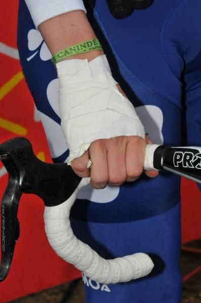 Yoann Offredo (Francaise Des Jeux) is riding with an injured hand.
