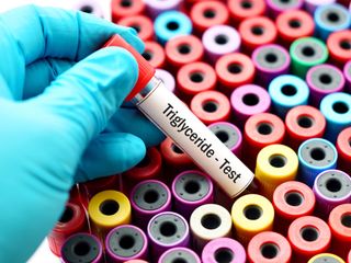 gloved hand holding a test tube labelled "triglyceride test"