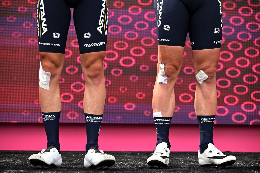 NAPLES ITALY MAY 11 LR Legs detail view of Christian Scaroni of Italy and Mark Cavendish of The United Kingdom and Astana Qazaqstan Team prior to the 106th Giro dItalia 2023 Stage 6 a 162km stage from Naples to Naples UCIWT on May 11 2023 in Naples Italy Photo by Stuart FranklinGetty Images