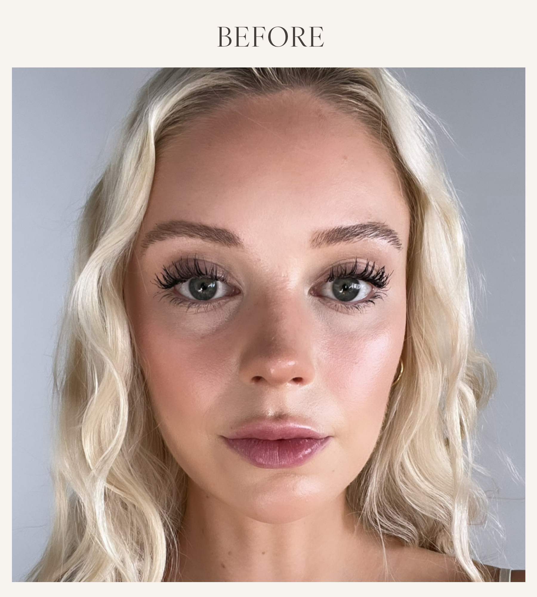 Before photo of Erin Jahns testing the Dr. Lara Devgan lip plumper 