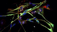 spindle-shape muscle cells shown depicted in bright green and blue against a black background