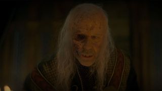 King Viserys after removing his mask to show his face in House Of The Dragon.