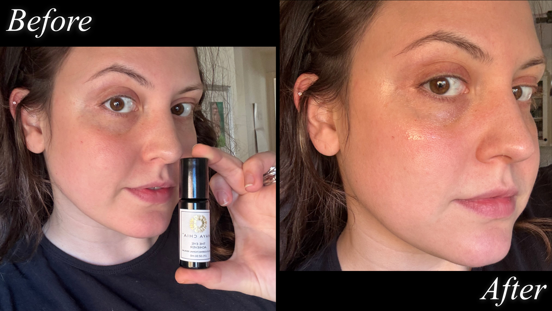Contributing beauty writer Sophia Vilensky before and after testing Maya Chia&#039;s eye serum.