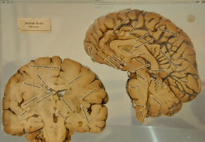 Labeled brain cross section