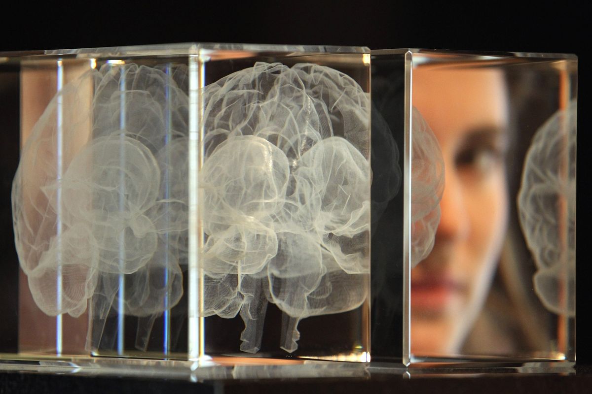 AI can detect Alzheimer’s a decade before symptoms show