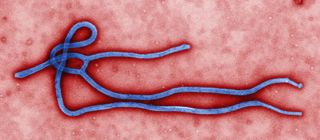 This image shows the structure of an Ebola virus particle. Ebola causes high fever and severe internal bleeding, and it is often fatal.
