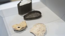 Fragments of Beethoven's skull