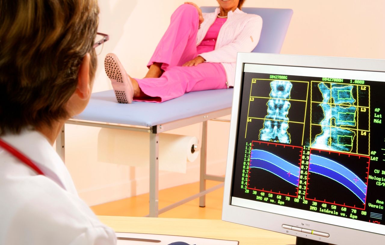 I hit menopause and found I was osteopenic this is what cyclists