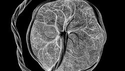 illustration shows a black and white depiction of the fetal side of the placenta