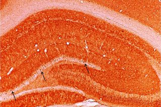 The Arc protein (dark spots) gets expressed by the Arc gene when a memory forms in the hippocampus. 