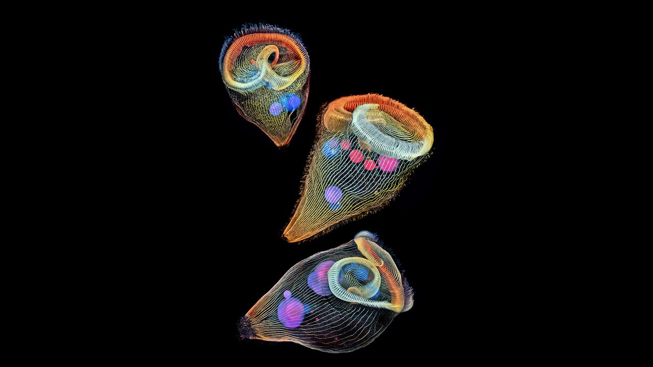 An image of trumpet-shaped single-cell organisms called stentors took second place in the Nikon Small World contest.