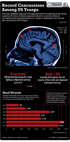 Roadside bombs and other explosions result in head trauma for troops in Afghanistan and Iraq.