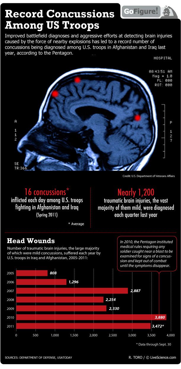 Roadside bombs and other explosions result in head trauma for troops in Afghanistan and Iraq.