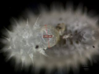 A microscope view of the head of a developing <em>Odontomachus brunneus</em> larva. The head is just 0.02 inches (0.49 mm) across.