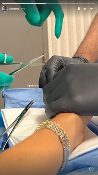 Zendaya's finger being worked on by medical professionals