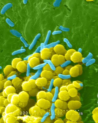 A colorized scanning electron micrograph of bacteria. Scanning electron microscopes allow scientists to see the three-dimensional surface of their samples.