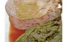 5-meconium-placenta.jpg