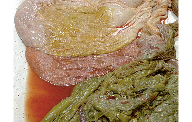 5-meconium-placenta.jpg