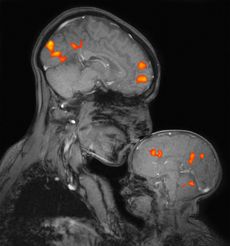 An MRI image of a mother and her sleeping baby.