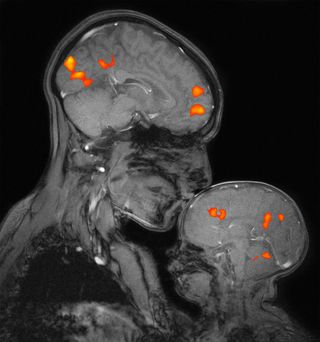 An MRI image of a mother and her sleeping baby.