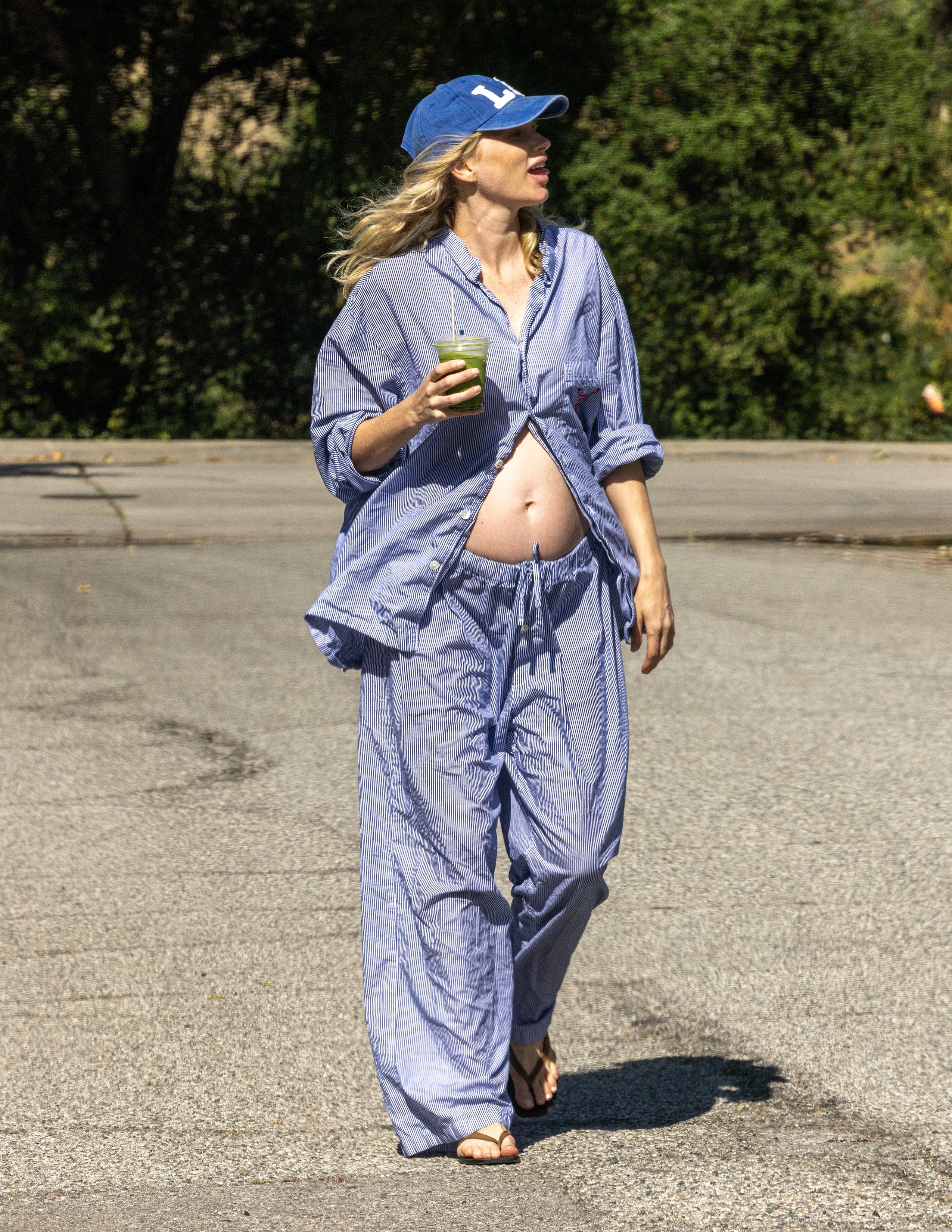 Elsa Hosk wears a baseball cap, stripe button-down shirt, drawstring pants, and flip flops.