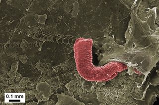 False-coloured electron micrograph of a marine worm on a 6mm plastic fragment (polyethylene).