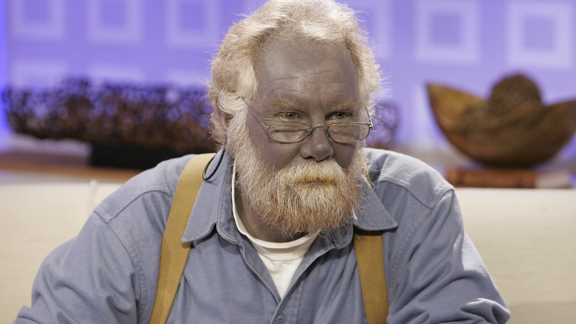 Argyria: The rare disease that turns people blue