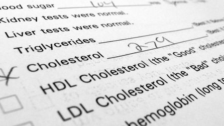 lab results showing cholesterol is high with a level of 279