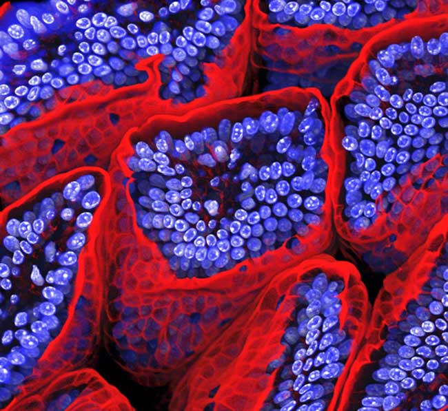 These finger-like structures in the small intestine of a mouse have been cropped at the tips and stained with fluorescent dyes to distinguish between different components of the cells. This image received an award from the Wellcome Trust, as part of the a
