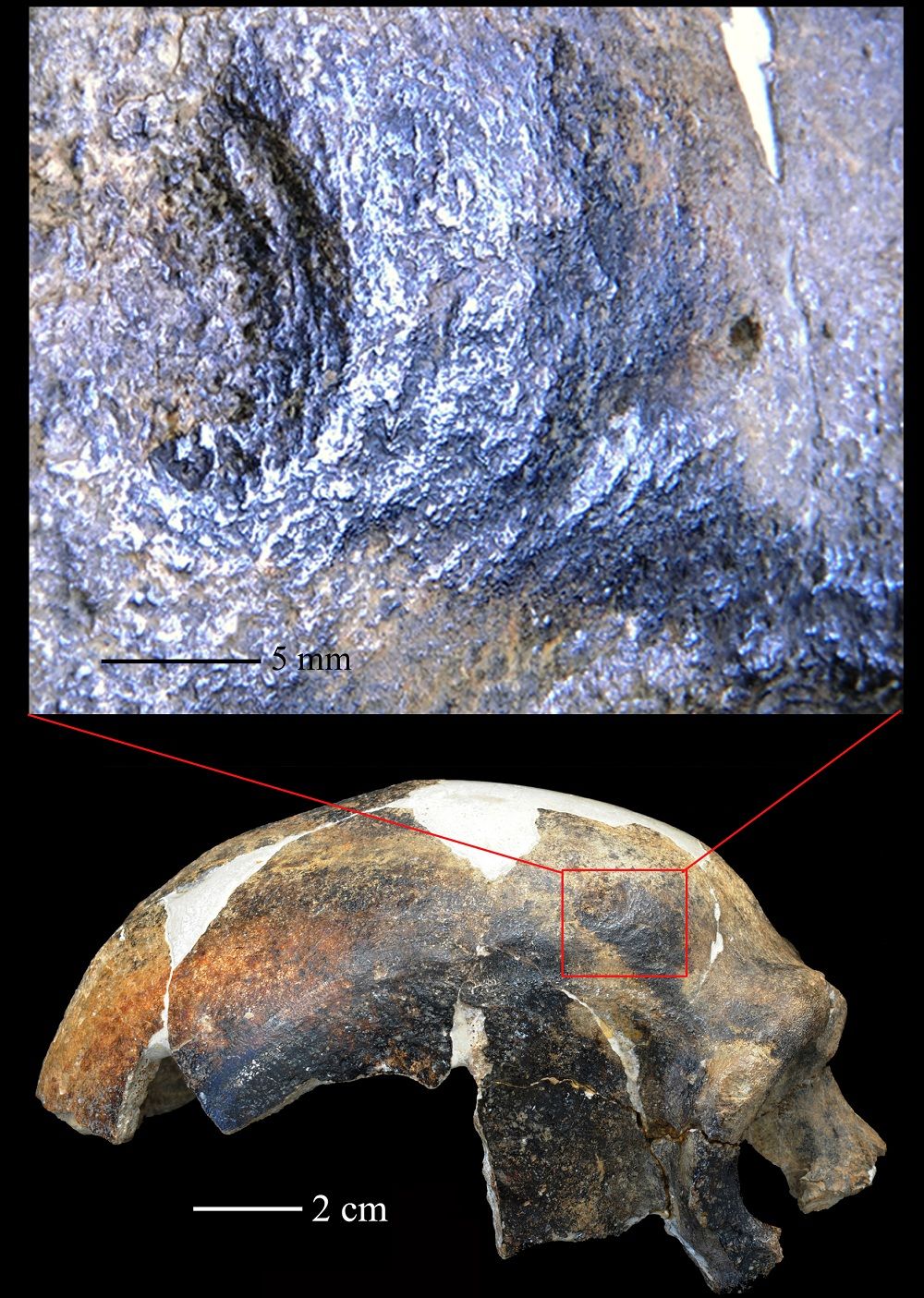 Ancient Human's Head Trauma Points to Foul Play | Live Science