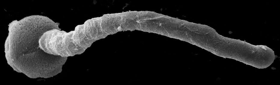 Pollen grain and pollen tube.