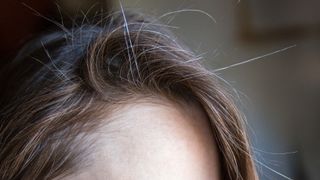 A close-up of a brunette woman's hairline revealing a few gray hairs