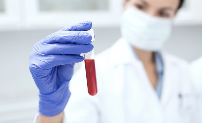 New Blood Test Can Detect 8 Types Of Cancer | Live Science