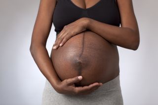 pregnancy - linea nigra