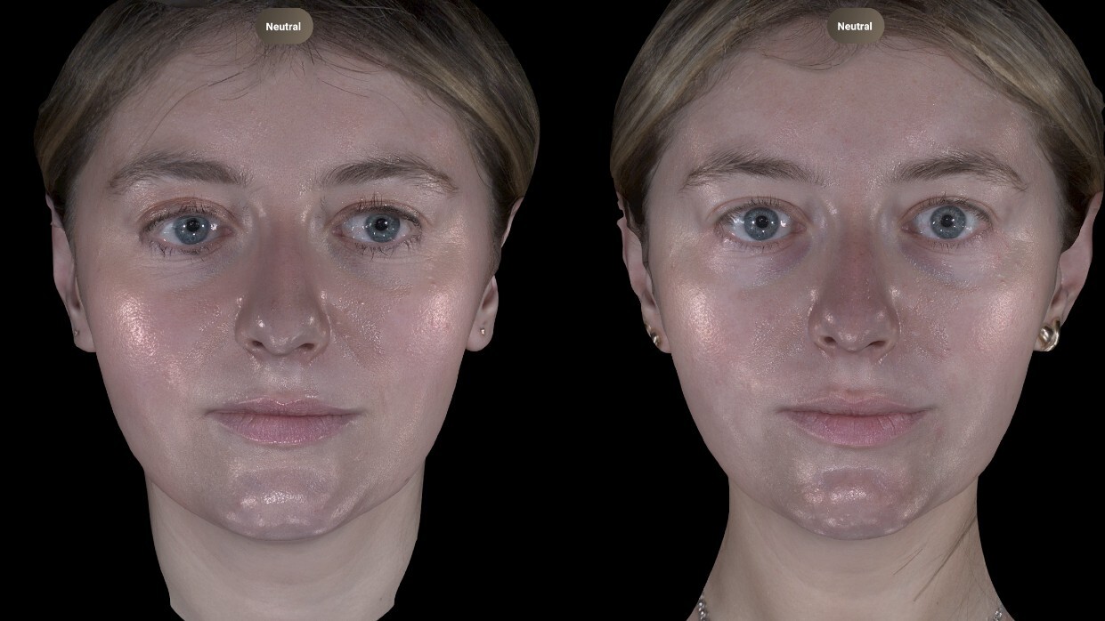 a before and after photo duo of a white woman with glowing skin
