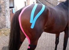 Kinesio taping