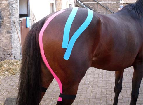 Kinesio taping