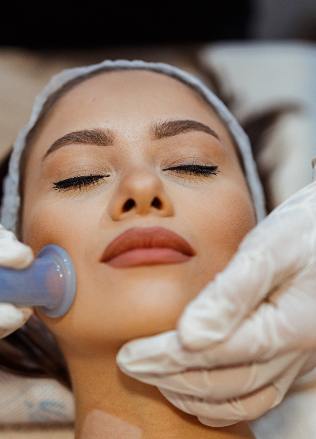 Cupping facial