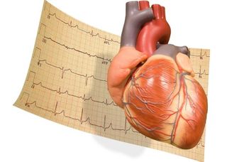 heart-ekg-11070502