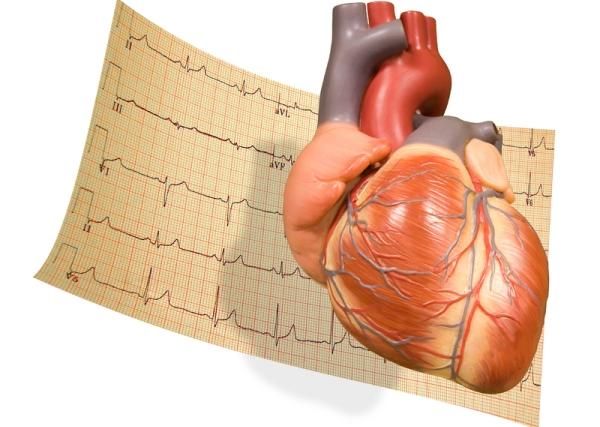 heart-ekg-11070502