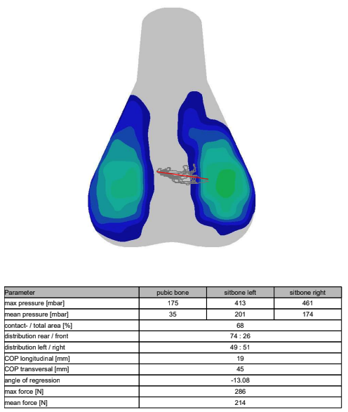 A visual output of saddle pressure mapping