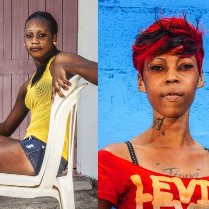 Why Black Women in a Predominately Black Culture Are Still Bleaching Their Skin