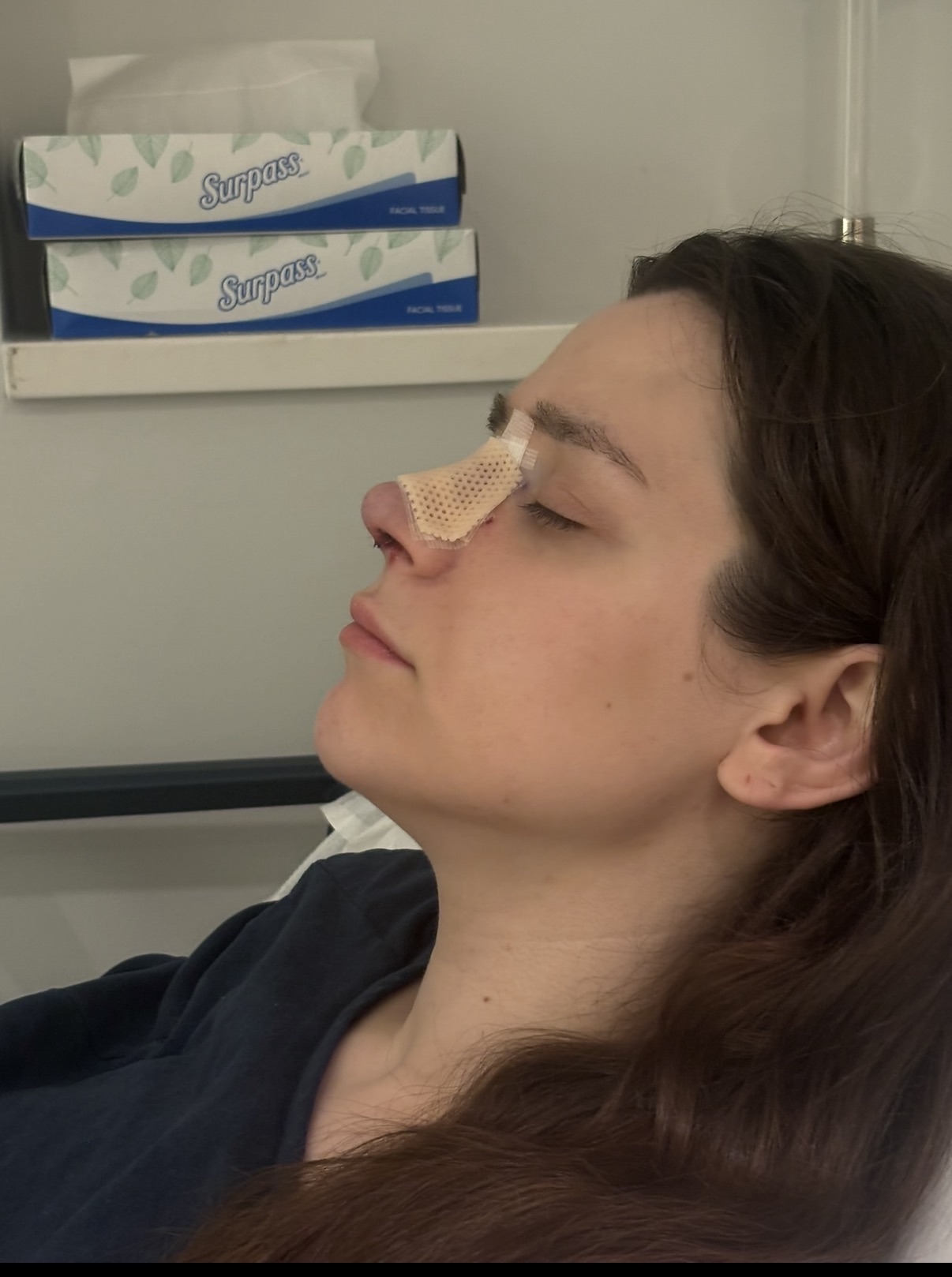 a girl right after a nose job procedure
