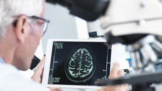 A scientist looks at a brain scan in a lab.