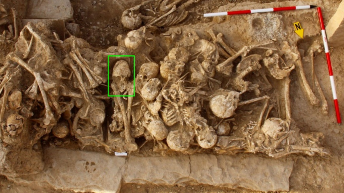 'Cone-headed' skull from Iran was bashed in 6,200 years ago, but no one knows why