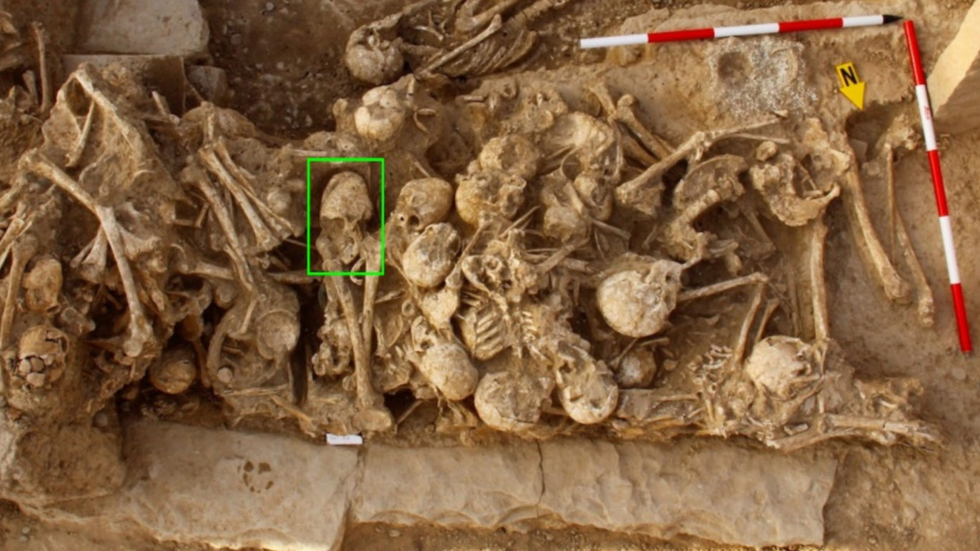 Burial of multiple human skeletons, with a green rectangle indicating the placement of a woman with cranial vault modification and a fracture