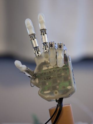 Feeling bionic hand